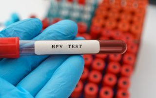 my texas health care obgyn HPV _ Pap Tests How Often To Get Screened For Cervical Cancer.jpg